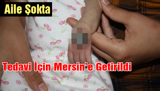 Yerinden çıkan Serum kelebeği bebeğin elini çürüttü