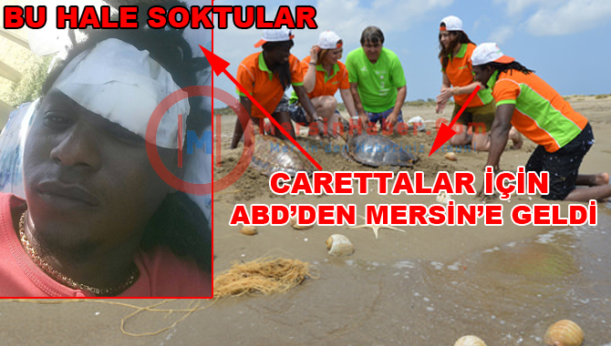 Güney Amerikalı Foto Model Mersin'de Saldırıya Uğradı