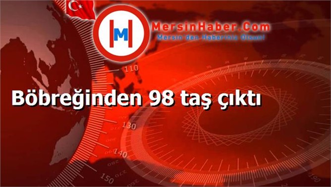 Böbreğinden 98 taş çıktı