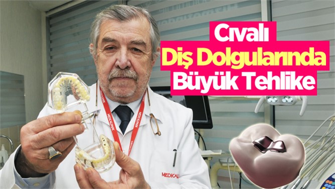 Cıvalı Diş Dolgularında Büyük Tehlike 