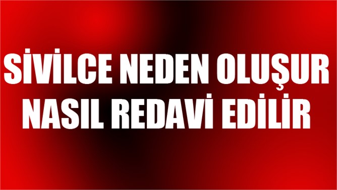 Sivilce nasıl tedavi edilir, neden oluşur, ergenlik sivilcesi