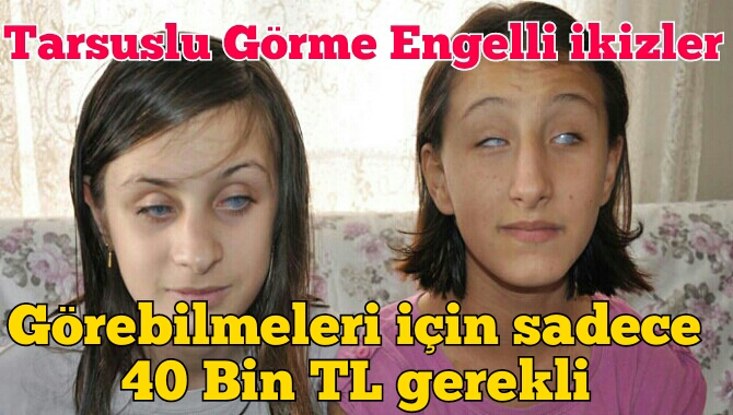 GÖRME ENGELLİ  İKİZLER TÜRKİYE GÜNDEMİNDE