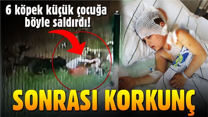 Küçük çocuğa 6 köpek saldırdı